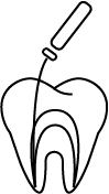 精密根管治療